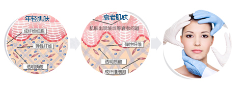 热玛吉除皱好不好?达到全面紧实回春的效果